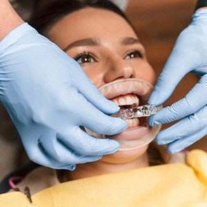 Dentist placing clear aligner on smiling patient