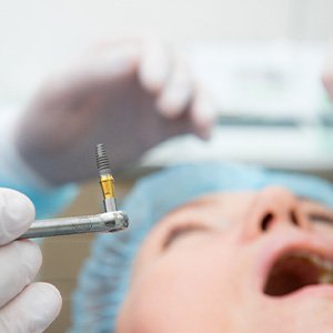 Gloved hands holding dental implant with patient blurry in background