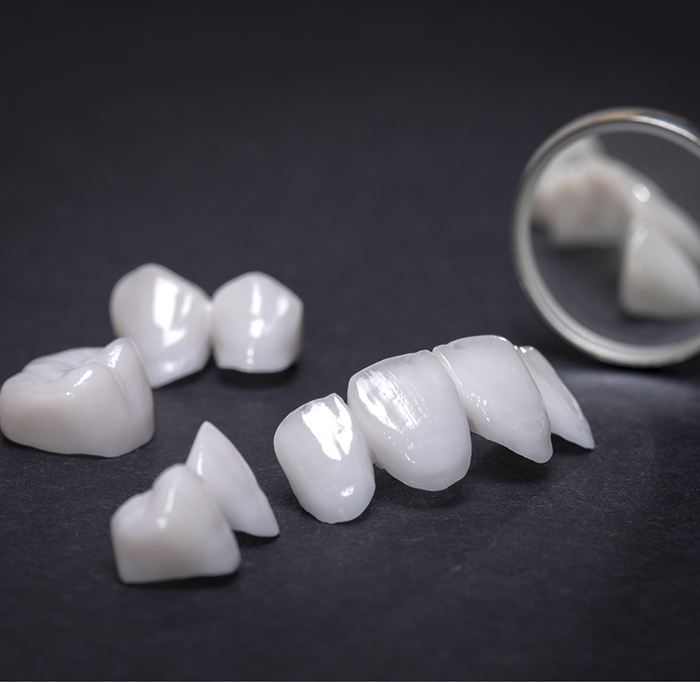 Veneers sitting on black surface next to dental mirror