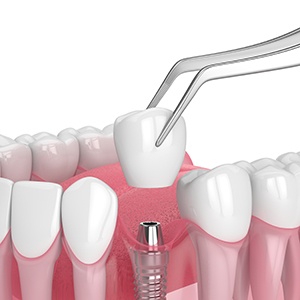 Dentist talking to smiling patient about dental implants