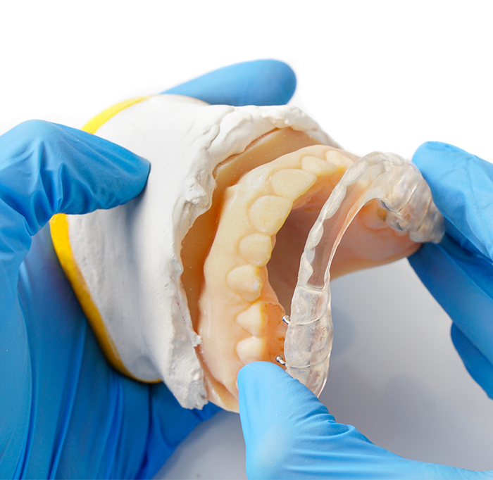 Removing oral appliance from model teeth